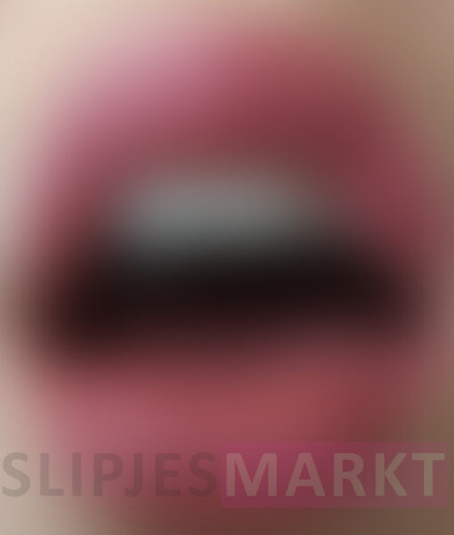 Foto's van mijn lippen